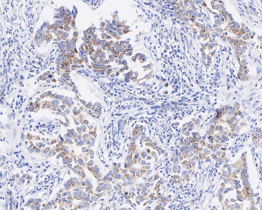 BMP-4 Antibody (JE42-44)