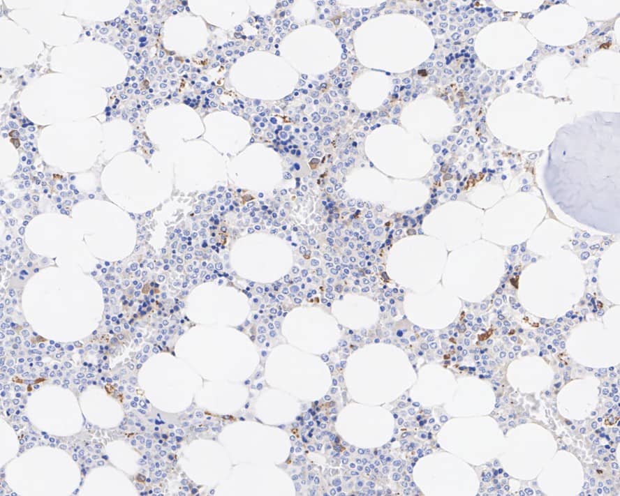 BNIP3L Antibody (JE59-98)