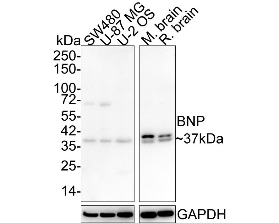 BNP Antibody (JE30-94)