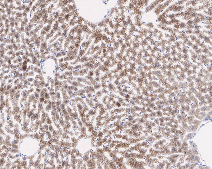 BNP Antibody (JE30-94)