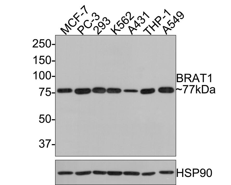 BAAT1 Antibody (JE64-71) Western Blot: BAAT1 Antibody (JE64-71) [NBP3-32089]