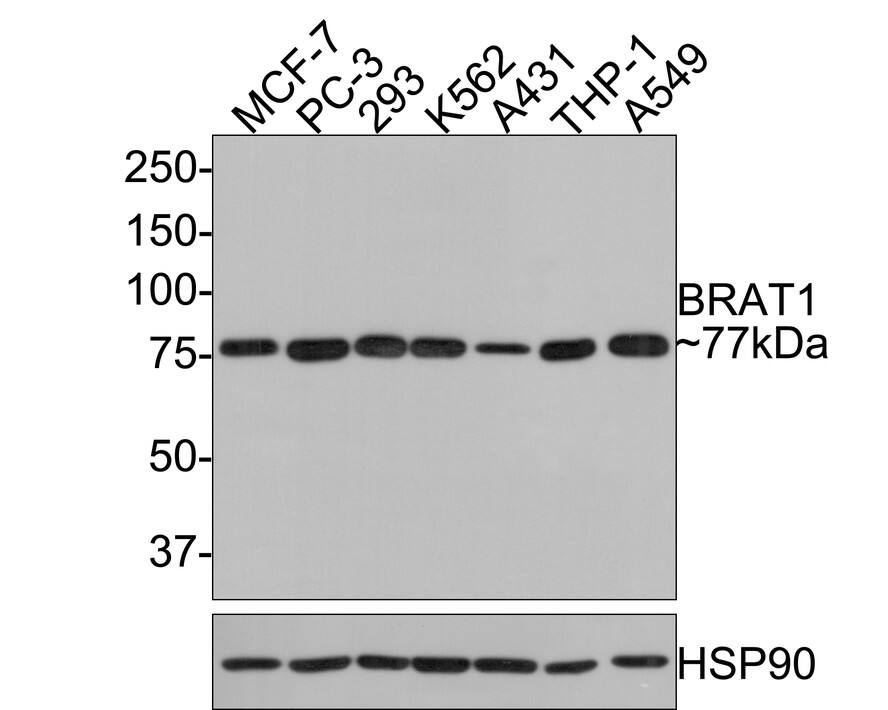 BAAT1 Antibody (JE64-71)