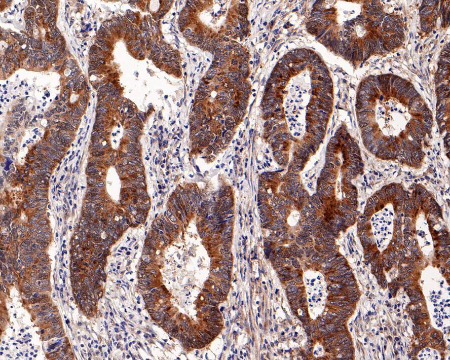 URI Antibody (PD00-48)