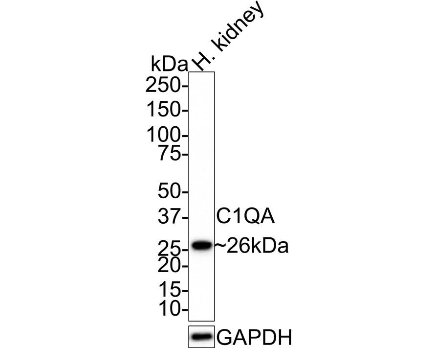 Complement Component C1qA Antibody (JE66-59)