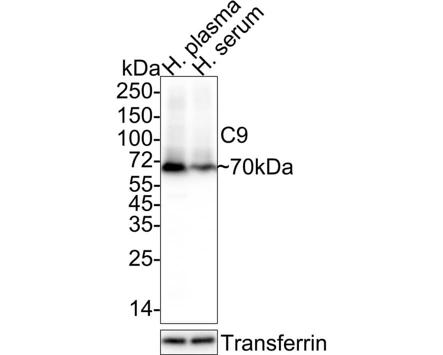 Complement Component C9 Antibody (JE01-45)