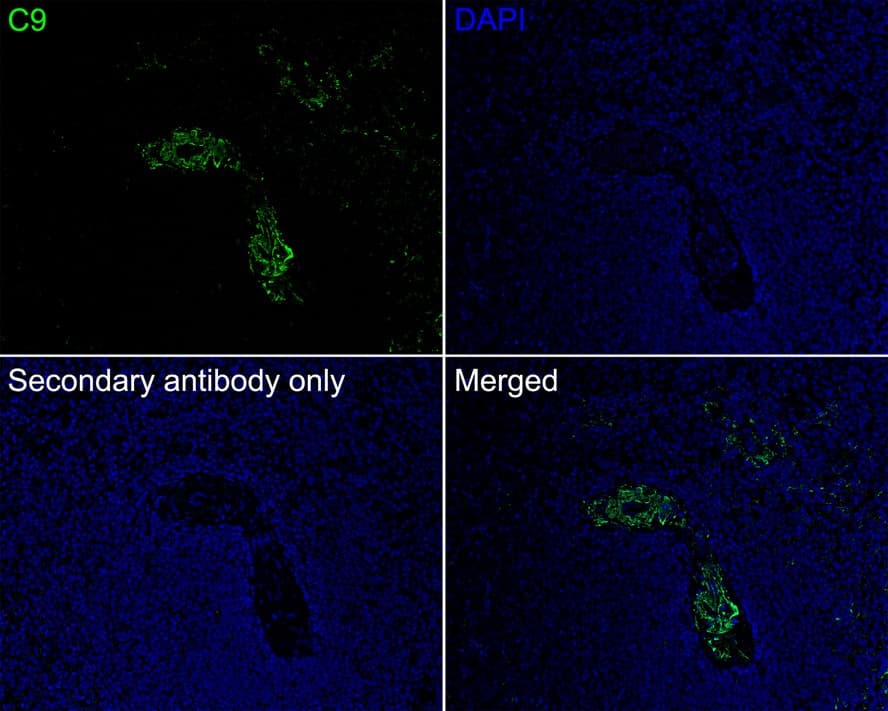 Complement Component C9 Antibody (JE01-45)