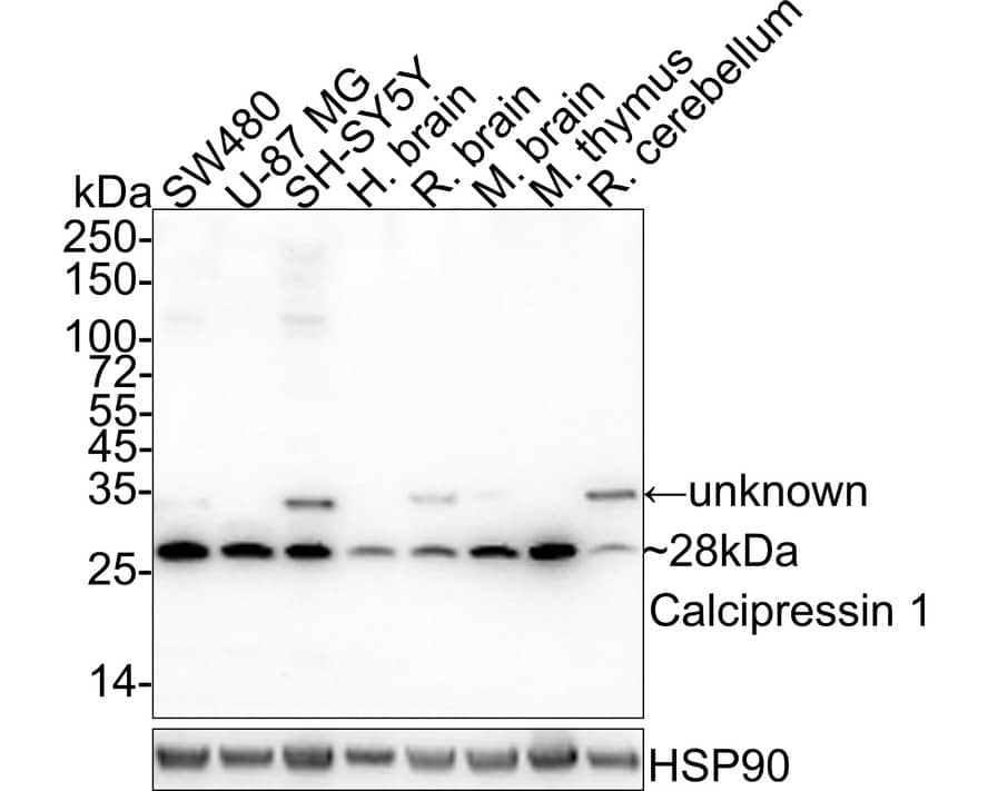 RCAN1 Antibody (JE62-71)