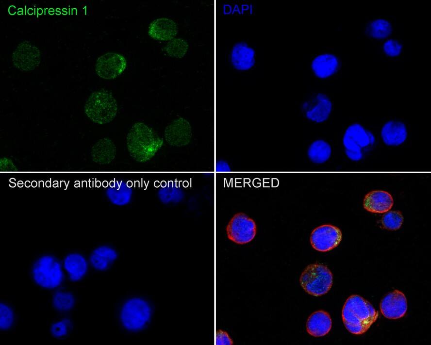 RCAN1 Antibody (JE62-71)