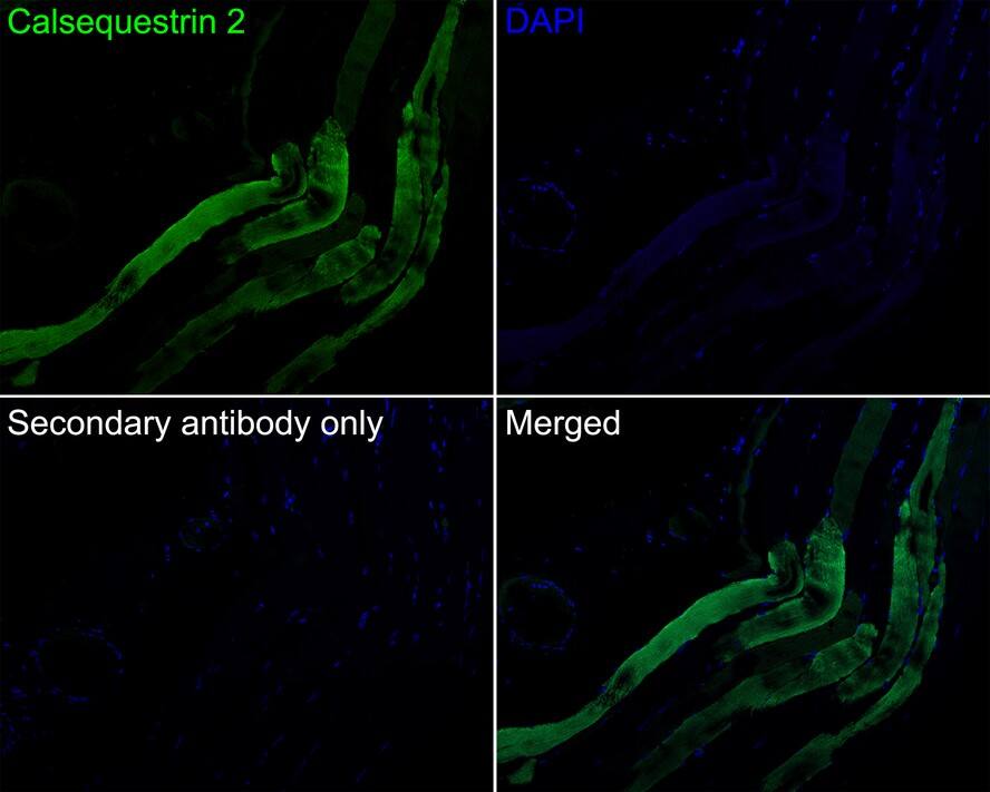 Calsequestrin 2 Antibody (PSH03-16)