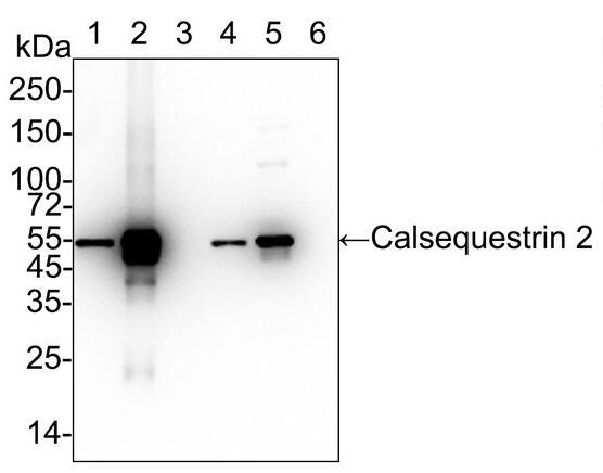 Calsequestrin 2 Antibody (PSH03-16)