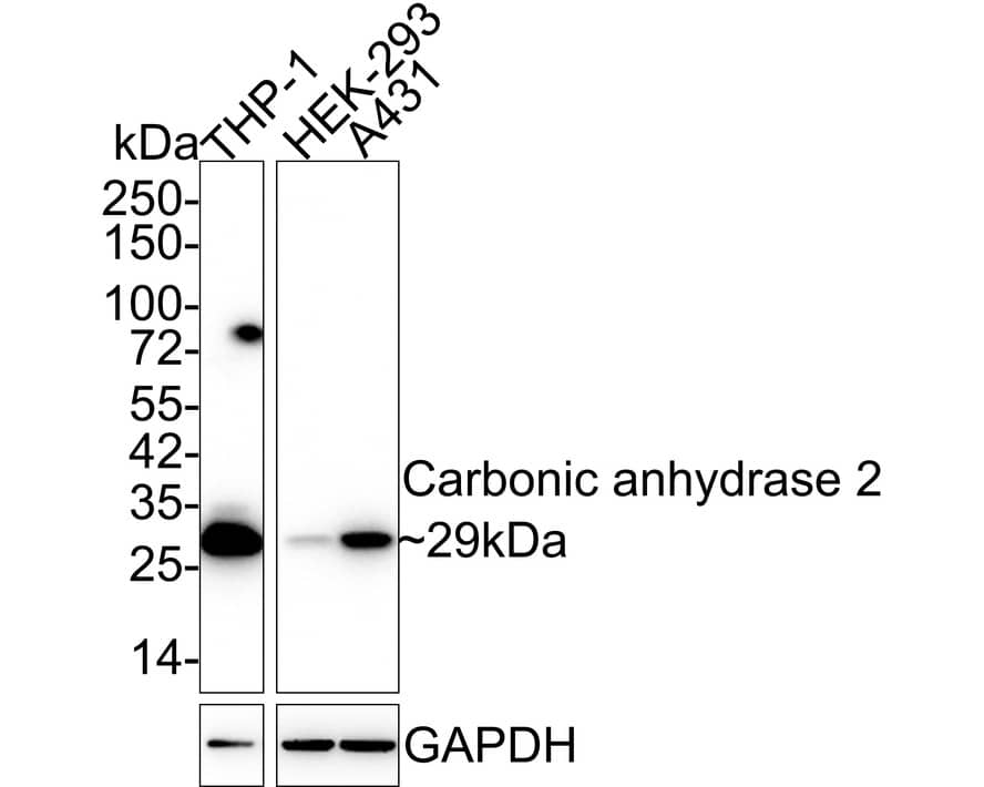 Carbonic Anhydrase II/CA2 Antibody (11A2-R)