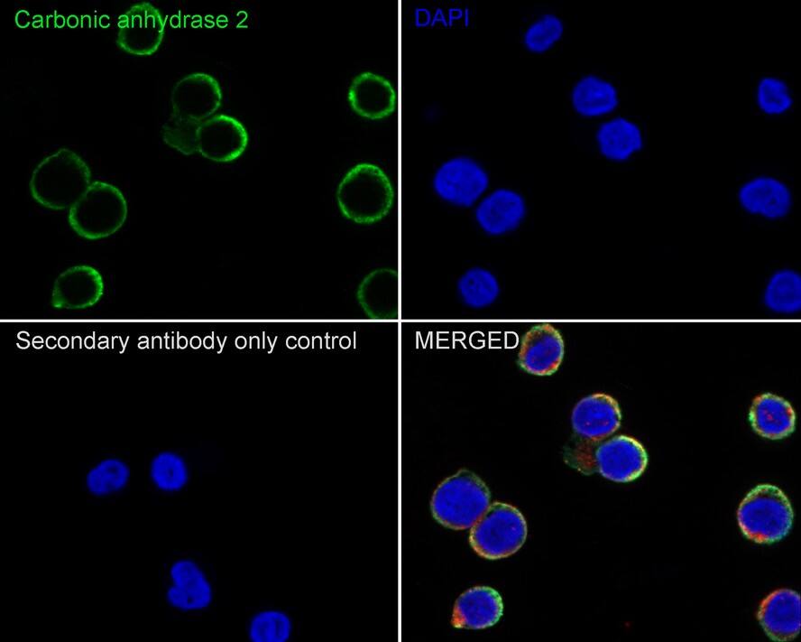 Carbonic Anhydrase II/CA2 Antibody (11A2-R)