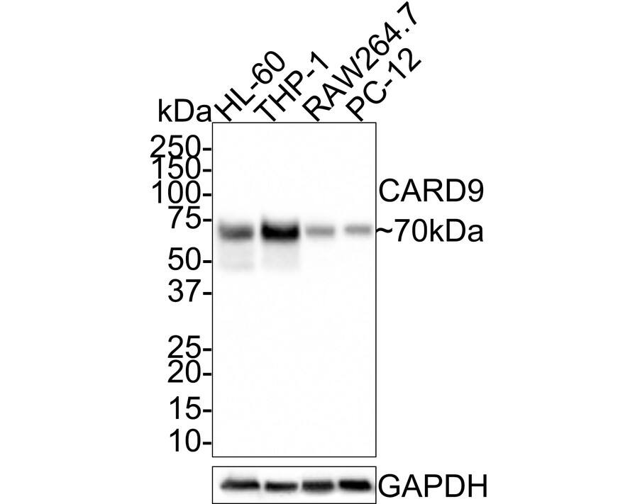 CARD9 Antibody (PSH0-41)