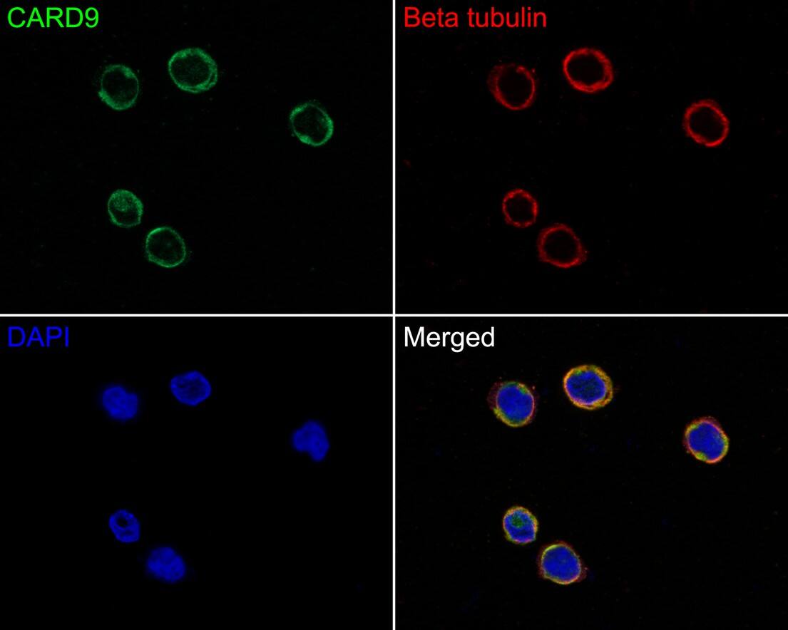 CARD9 Antibody (PSH0-41)