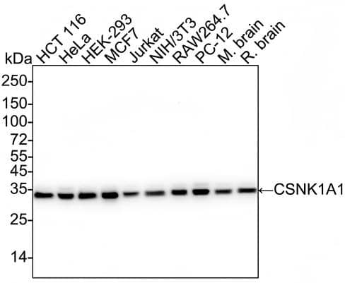 Casein Kinase 1 alpha Antibody (PSH04-46) Western Blot: Casein Kinase 1 alpha Antibody (PSH04-46) [NBP3-32107]