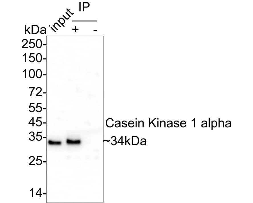 Casein Kinase 1 alpha Antibody (PSH04-46)