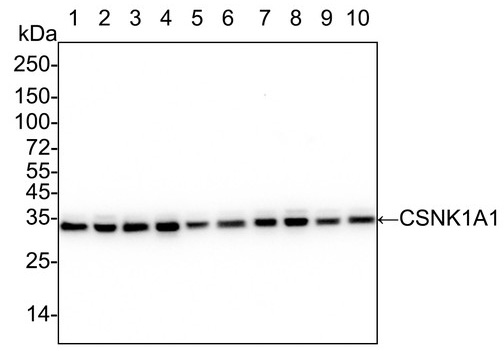 Casein Kinase 1 alpha Antibody (PSH04-46)