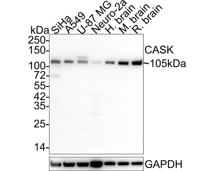 CASK Antibody (A1C5-R)