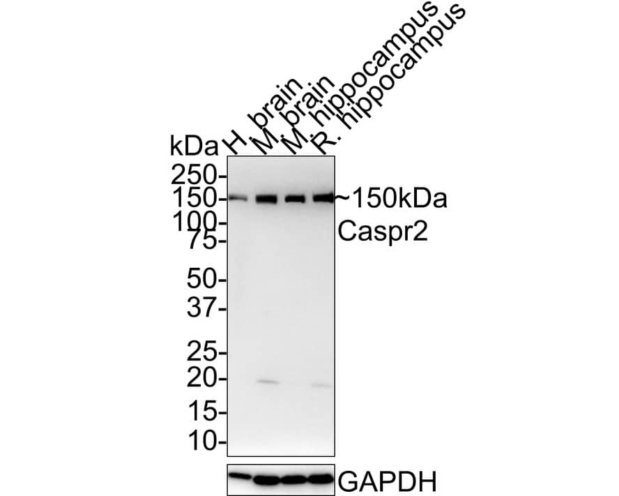 Caspr2 Antibody (JE41-03)