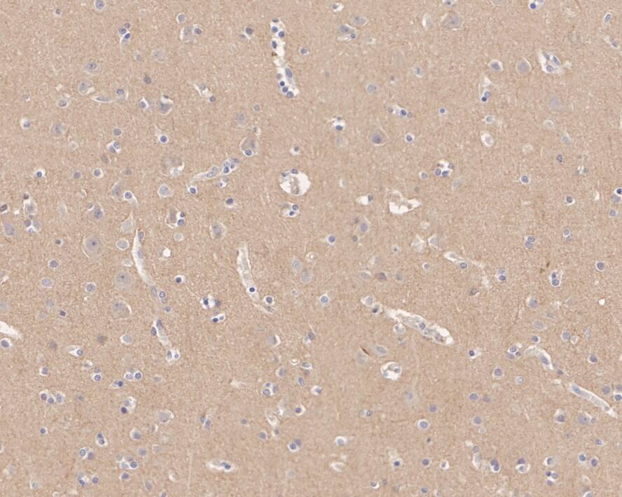 Caspr2 Antibody (JE41-03)