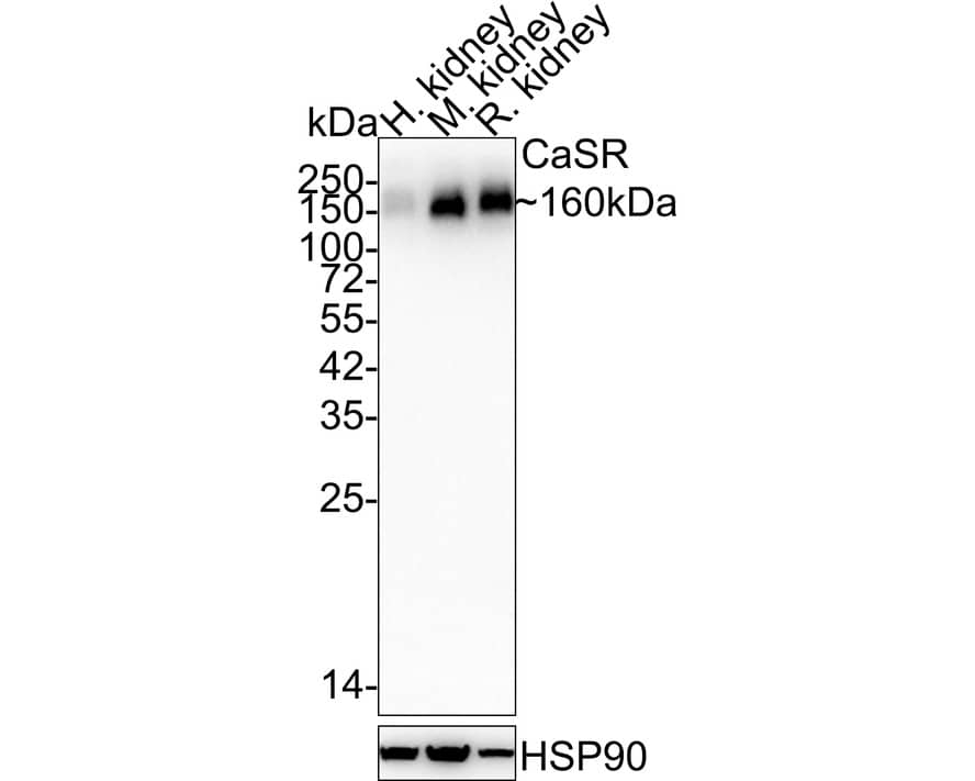 Calcium-sensing R/CaSR Antibody (PSH03-47)