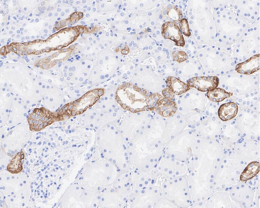 Calcium-sensing R/CaSR Antibody (PSH03-47)
