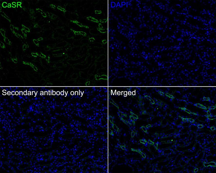 Calcium-sensing R/CaSR Antibody (PSH03-47)