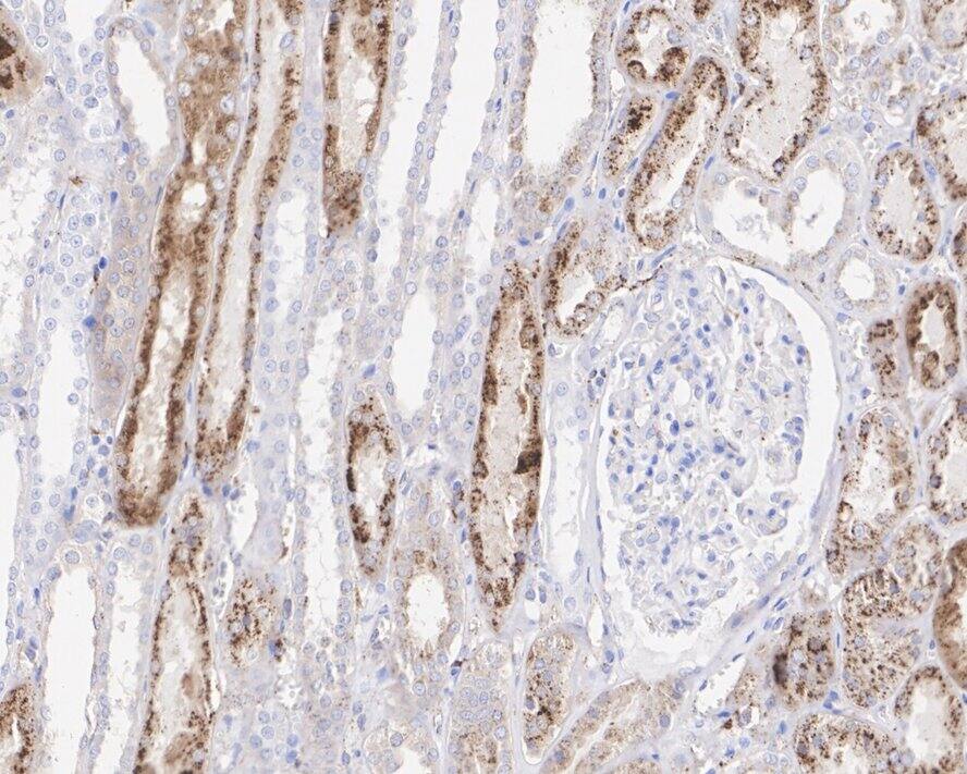 Cathepsin L Antibody (PSH03-92)