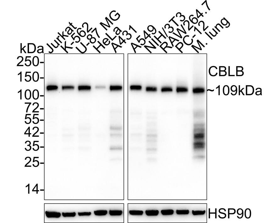 CBLB Antibody (PSH03-49)