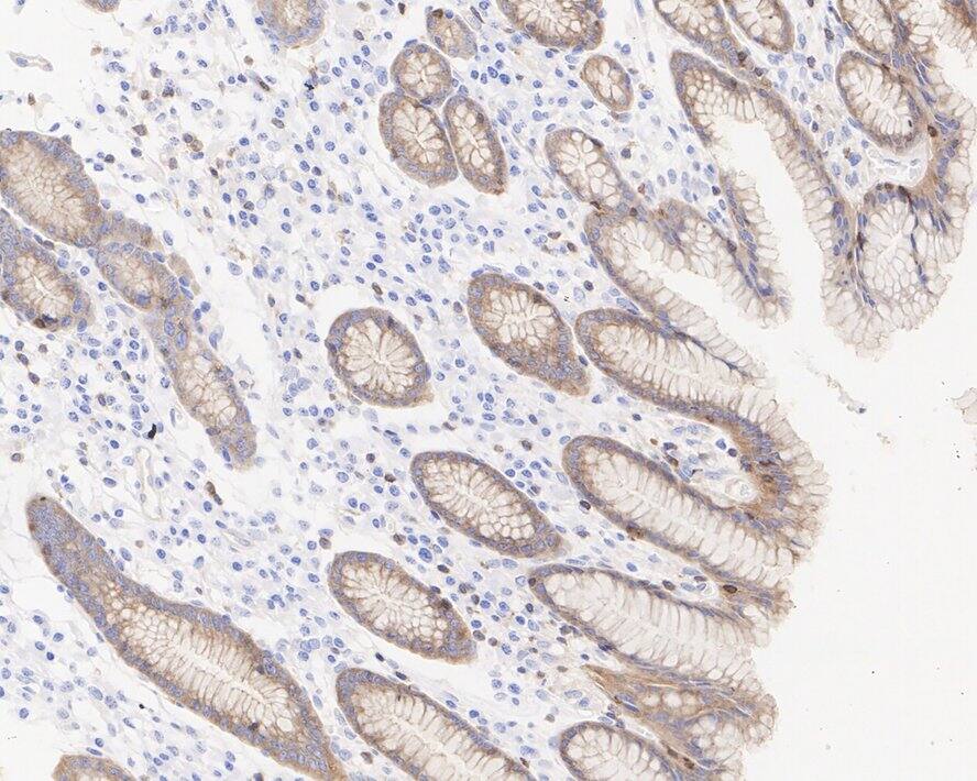 CBLB Antibody (PSH03-49)