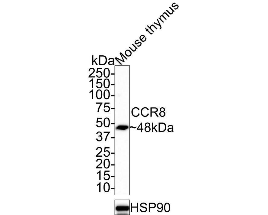 CCR8 Antibody (JE31-99)