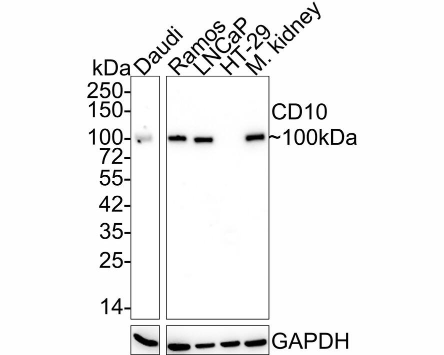 Neprilysin/CD10 Antibody (A1G3-R)