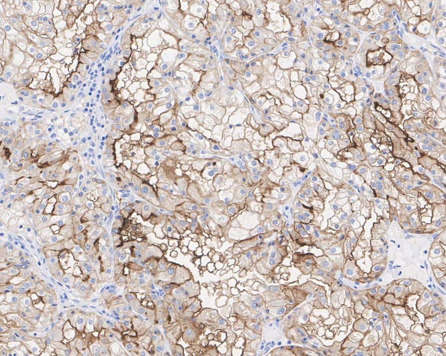 Neprilysin/CD10 Antibody (A1G3-R)