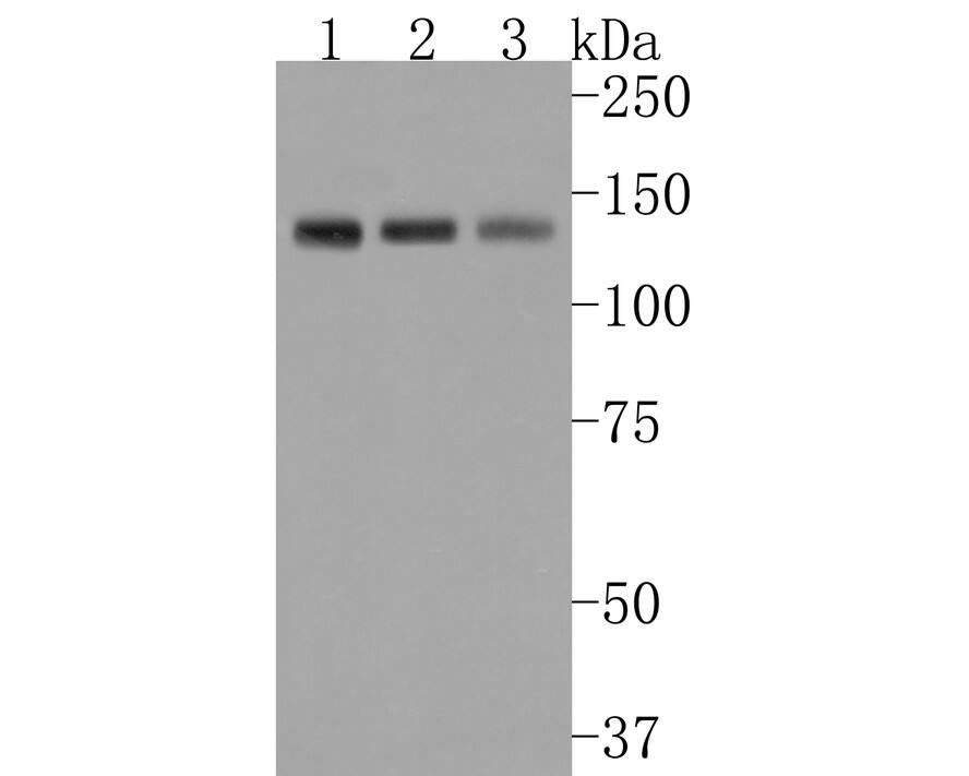 Semaphorin 4D/CD100 Antibody (JE63-21) Western Blot: Semaphorin 4D/CD100 Antibody (JE63-21) [NBP3-32119]