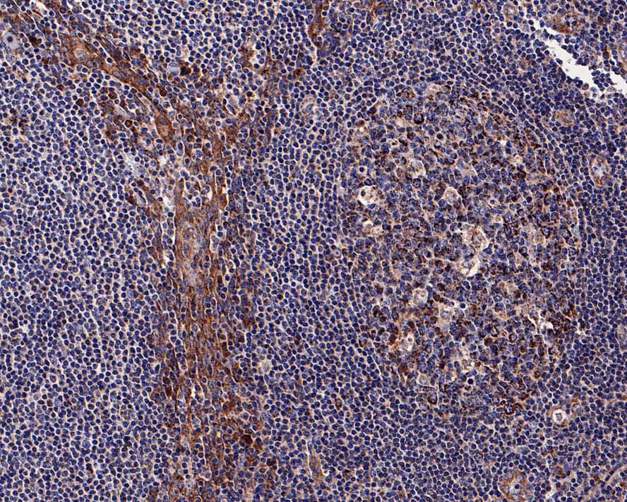 IL-7R alpha/CD127 Antibody (JE37-10)