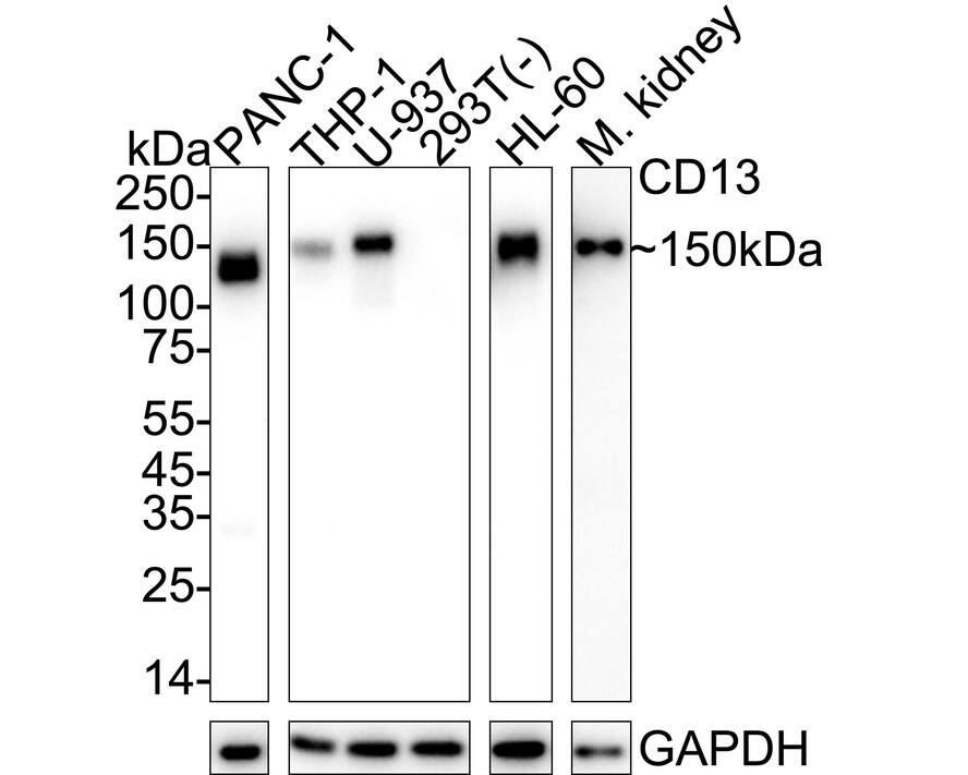 Aminopeptidase N/CD13 Antibody (PD00-39) Western Blot: Aminopeptidase N/CD13 Antibody (PD00-39) [NBP3-32123]