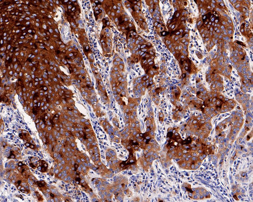 CD15/Lewis X Antibody (PD00-42)