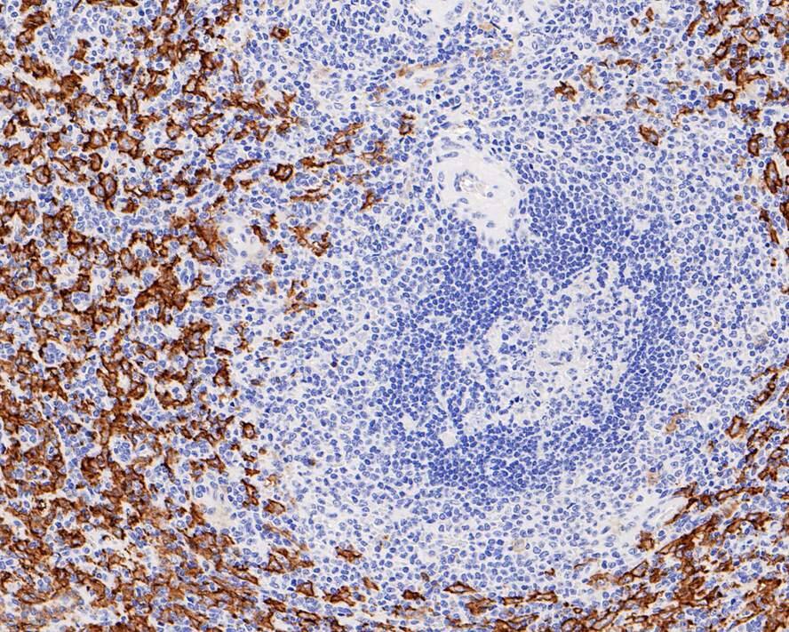 Fc gamma RIII (CD16) Antibody (PD00-12)