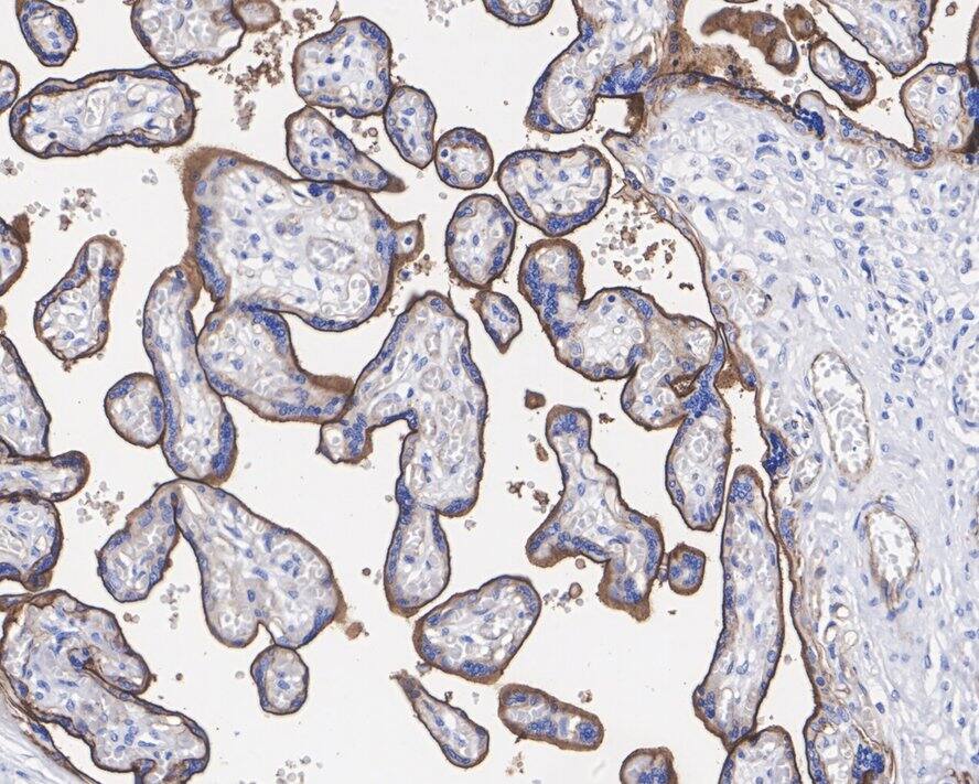 CD200/OX2 Antibody (PSH01-48)