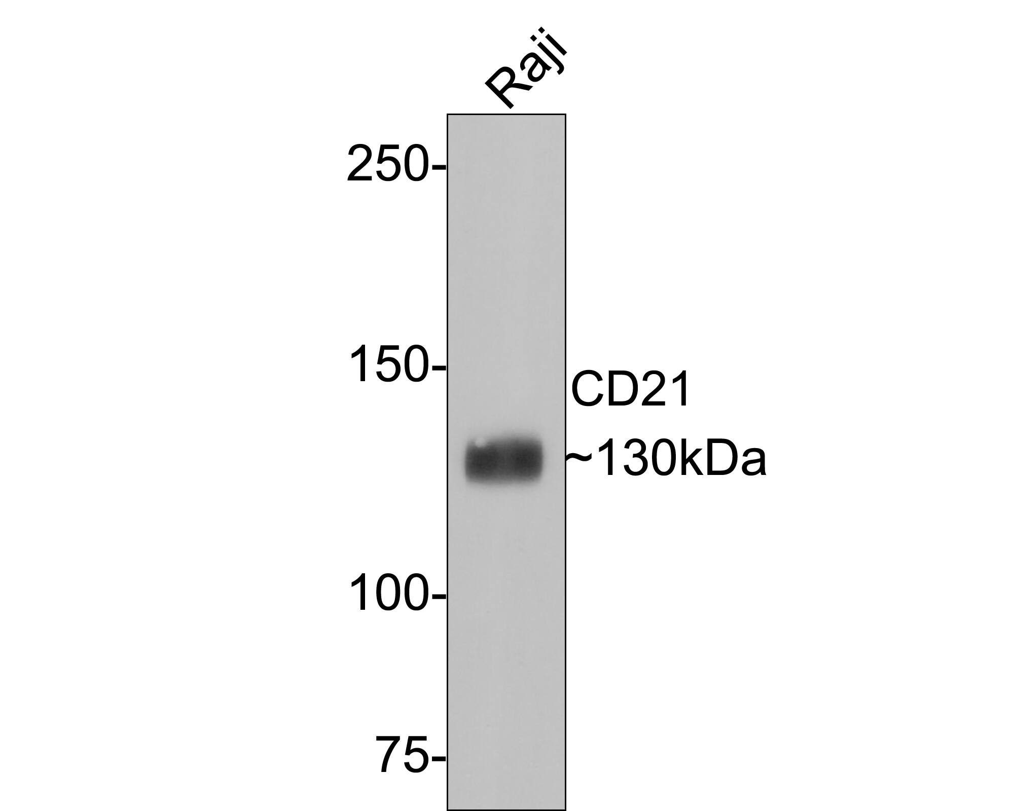 CD21 Antibody (PD00-23)