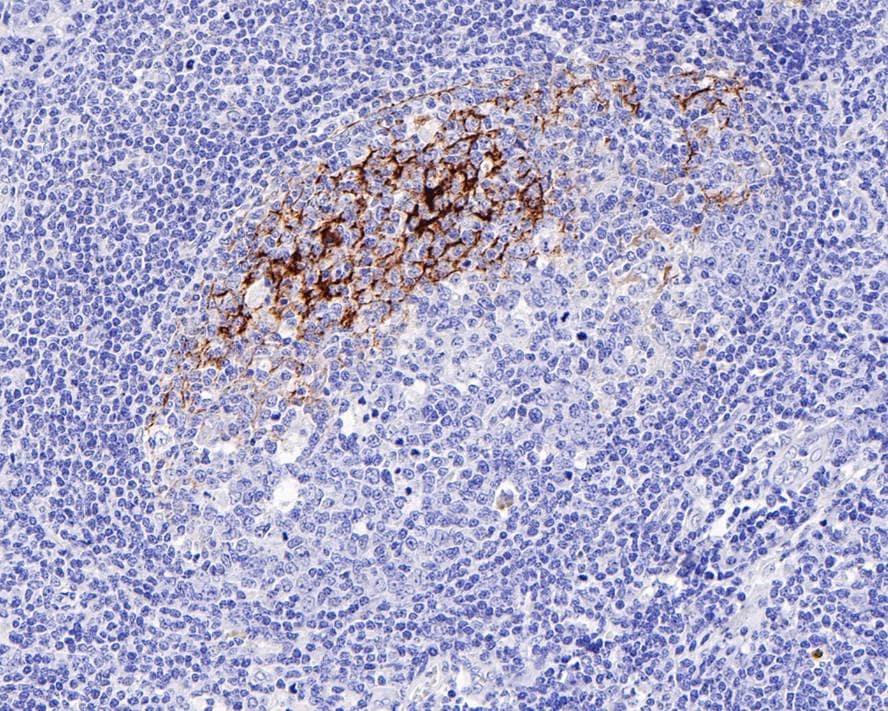 CD23/Fc epsilon RII Antibody (PD00-03)