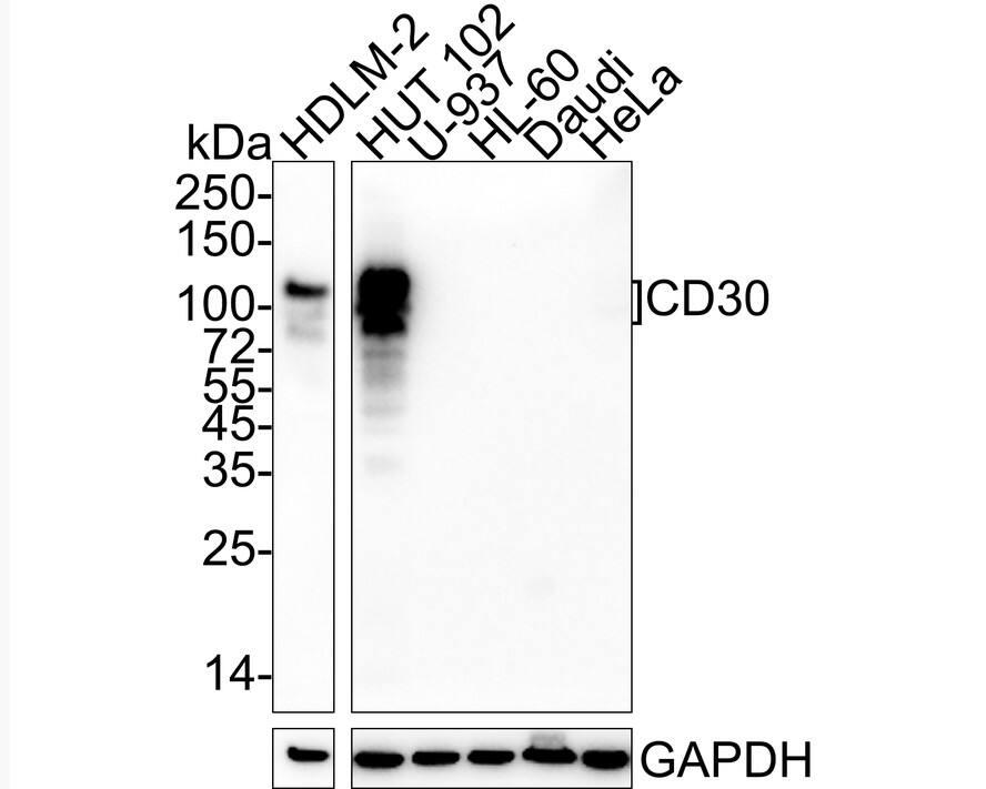 CD30/TNFRSF8 Antibody (PSH04-12)