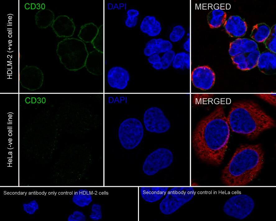 CD30/TNFRSF8 Antibody (PSH04-12)