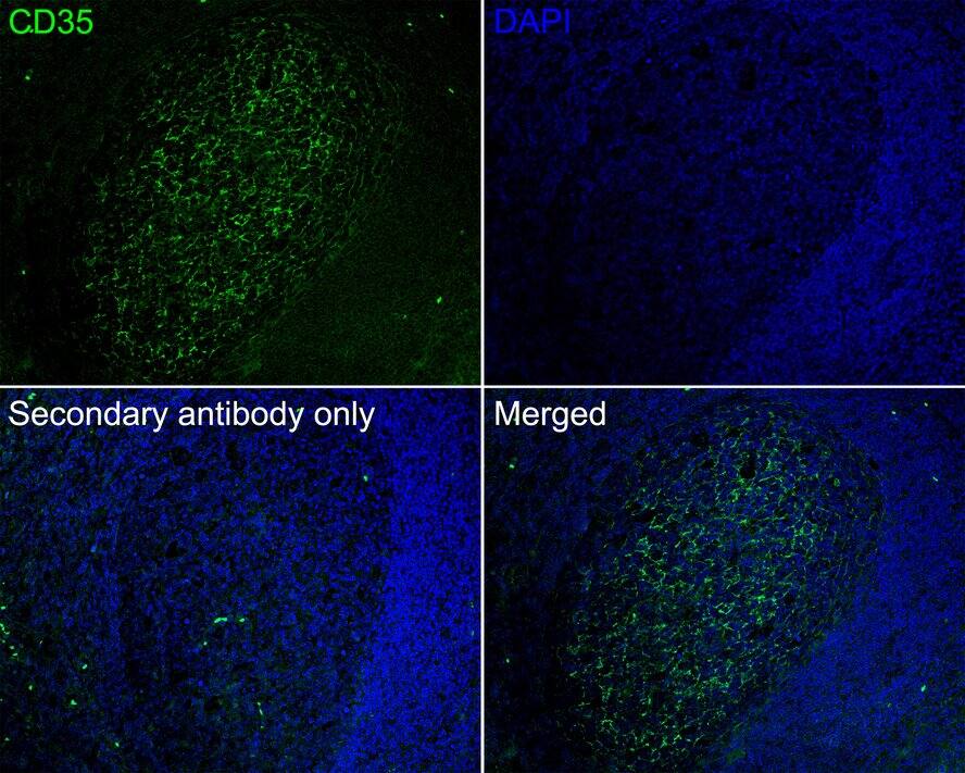 CD35 Antibody (A4F3-R)
