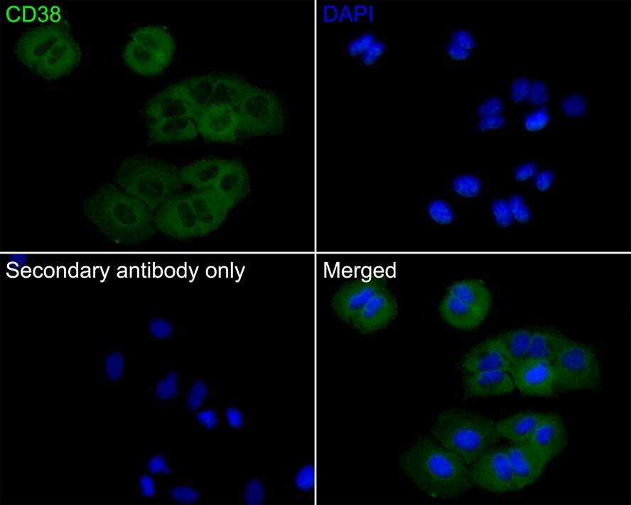 CD38 Antibody (PD01-49)