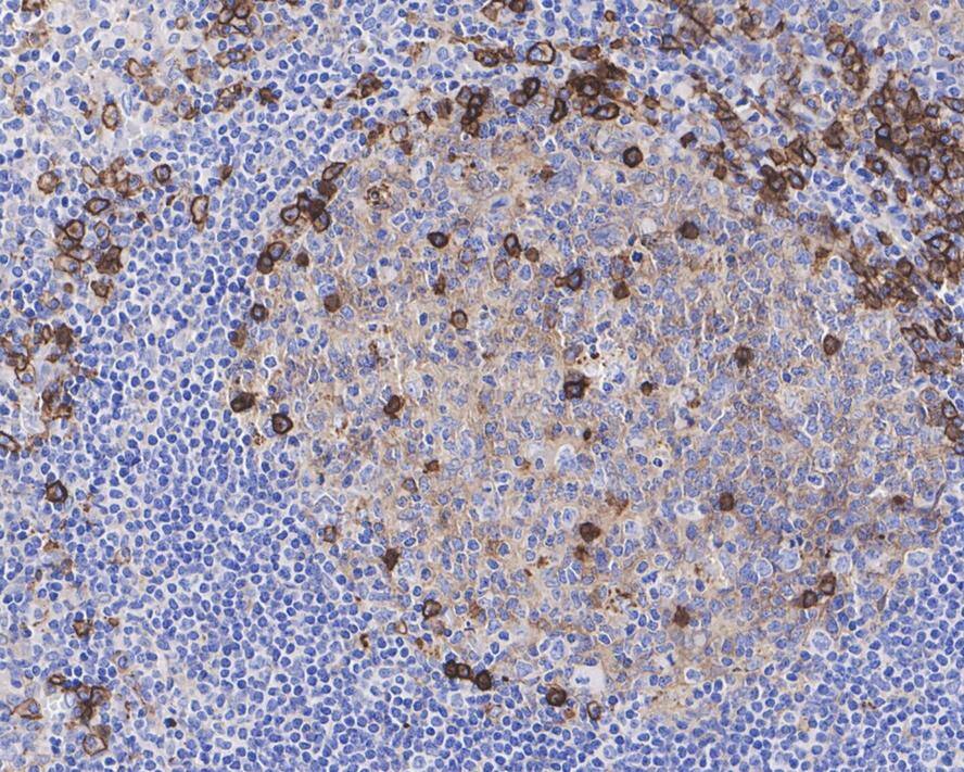CD38 Antibody (PD01-49)