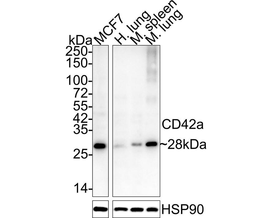 GP-IX Antibody (A5E6-R)