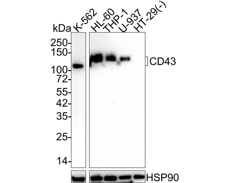 CD43/Sialophorin Antibody (A2F8-R) Western Blot: CD43/Sialophorin Antibody (A2F8-R) [NBP3-32154]