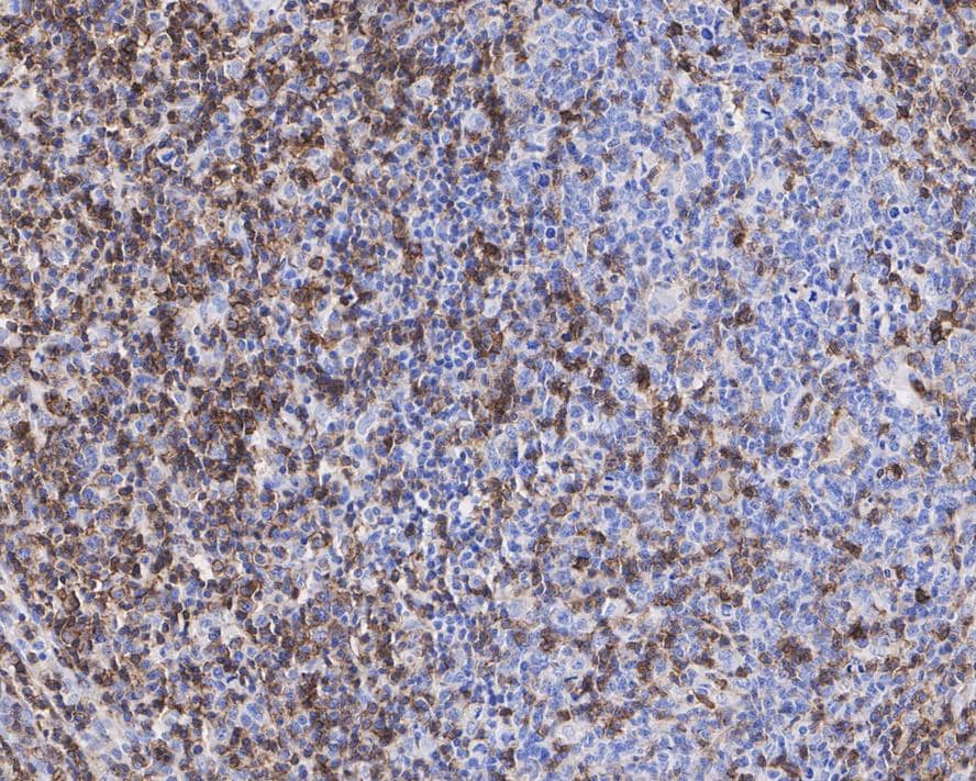 CD43/Sialophorin Antibody (A2F8-R)