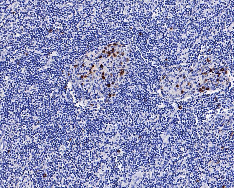 CD57 Antibody (PD00-21)